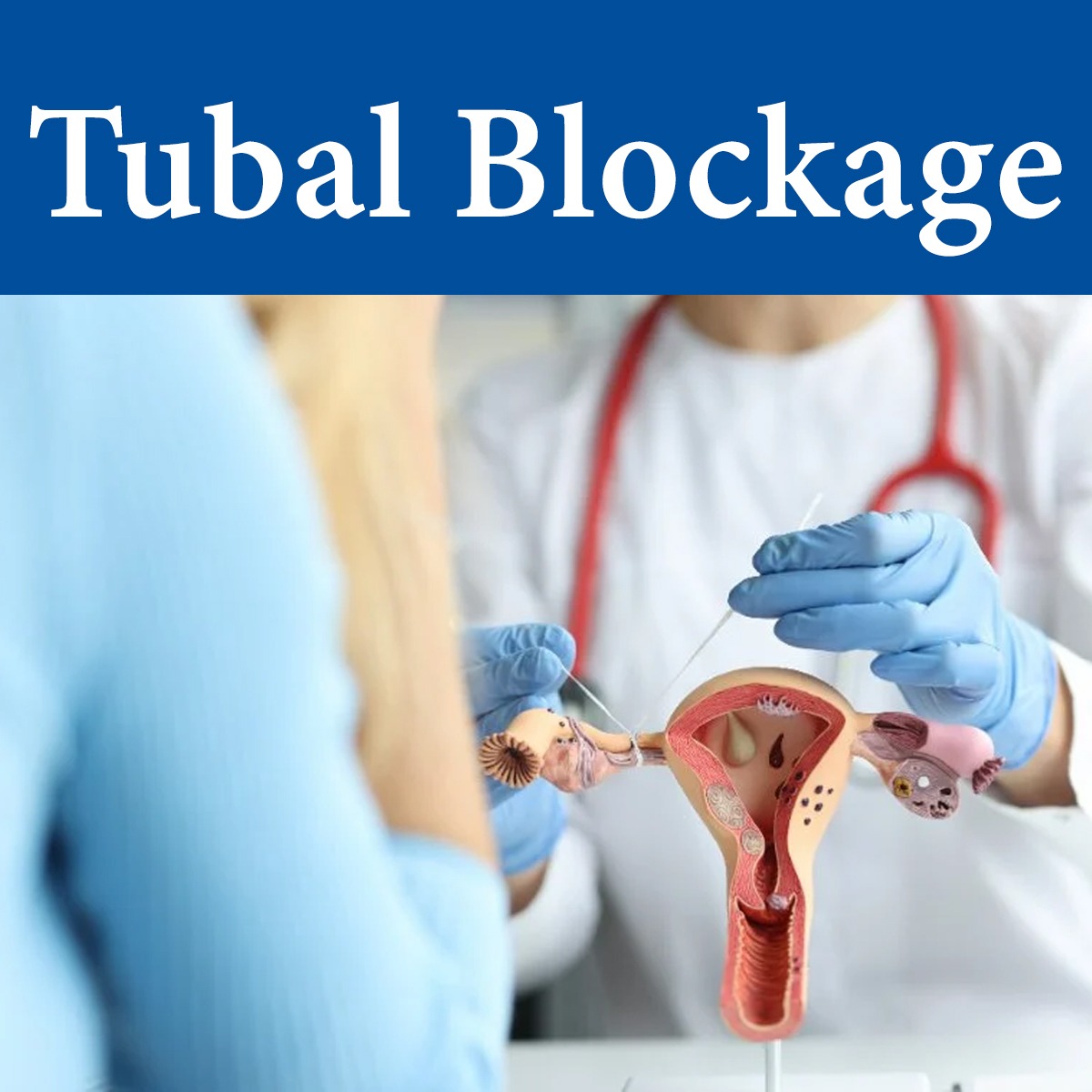 Best doctor for fallopian tube blockage  